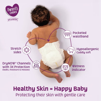 Parent's Choice Dry & Gentle Diapers Size 2, 240 Count (Select for More Options)